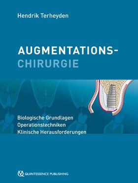 Terheyden | Augmentationschirurgie | E-Book | sack.de