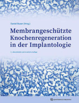 Buser | Membrangeschützte Knochenregeneration in der Implantologie | Buch | 978-3-86867-587-0 | sack.de