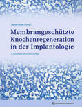 Buser |  Membrangeschützte Knochenregeneration in der Implantologie | Buch |  Sack Fachmedien