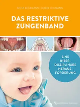 Uhlmann / Beckmann | Das restriktive Zungenband | Buch | 978-3-86867-610-5 | sack.de