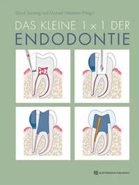 Sonntag / Hülsmann | Das kleine 1x1 der Endodontie | Buch | 978-3-86867-611-2 | sack.de