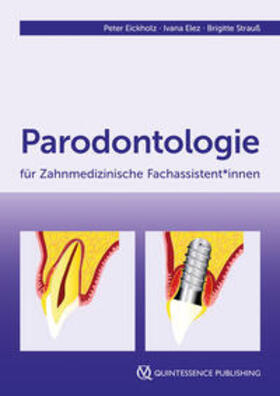 Eickholz / Elez / Strauß | Parodontologie für Zahnmedizinische Fachassistent*innen | Buch | 978-3-86867-624-2 | sack.de
