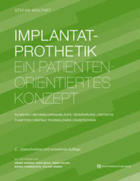 Wolfart | Implantatprothetik | E-Book | sack.de
