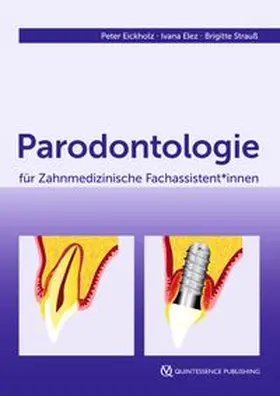 Eickholz / Elez / Strauß |  Parodontologie für Zahnmedizinische Fachassistent*innen | eBook | Sack Fachmedien