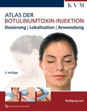 Jost |  Atlas der Botulinumtoxin-Injektion | eBook | Sack Fachmedien