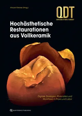 Fehmer |  Hochästhetische Restaurationen aus Vollkeramik | Buch |  Sack Fachmedien