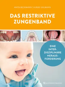 Beckmann / Uhlmann |  Das restriktive Zungenband | eBook | Sack Fachmedien