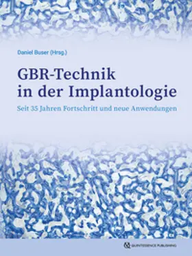 Buser |  GBR-Technik in der Implantologie | eBook | Sack Fachmedien
