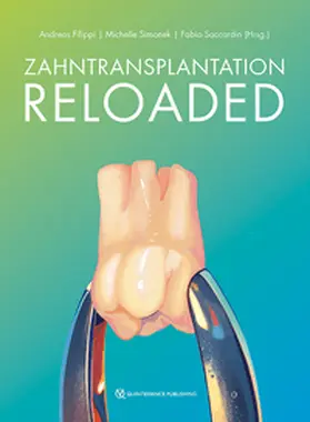 Filippi / Simonek / Saccardin |  Zahntransplantation Reloaded | eBook | Sack Fachmedien