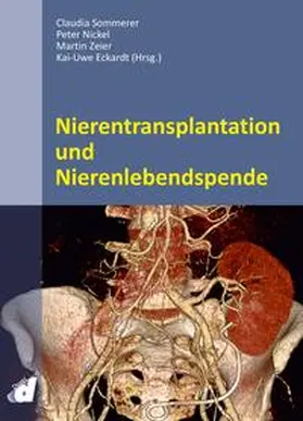 Sommerer / Nickel / Zeier |  Nierentransplantation und Nierenlebendspende | Buch |  Sack Fachmedien