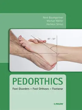 Baumgartner / Moeller / Stinus |  Pedorthics | Buch |  Sack Fachmedien