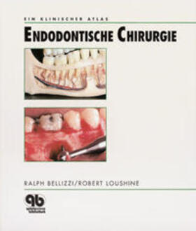 Bellizzi / Loushine | Endodontische Chirurgie | Buch | 978-3-87652-163-3 | sack.de