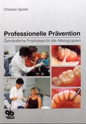 Splieth |  Professionelle Prävention | Buch |  Sack Fachmedien