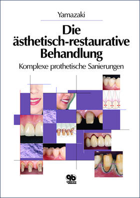 Yamazaki | Ästhetisch-restaurative Behandlung | Buch | 978-3-87652-533-4 | sack.de