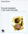 Watzek |  Enossale Implantate in der oralen Chirurgie | Buch |  Sack Fachmedien