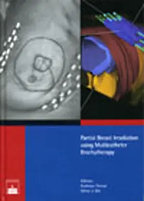 Strnad / Ott |  Partial Breast Irradiation using Multicatheter Brachytherapy | Buch |  Sack Fachmedien