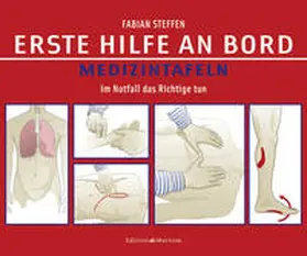 Steffen |  Erste Hilfe an Bord – Medizintafeln | Buch |  Sack Fachmedien