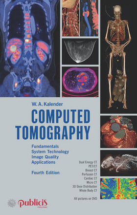Kalender | Computed Tomography, w. DVD-ROM | Buch | sack.de