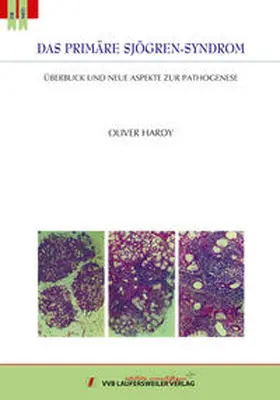 Hardy |  Das primäre Sjögren-Syndrom: Überblick und neue Aspekte zur Pathogenese | Buch |  Sack Fachmedien