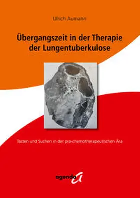 Aumann |  Übergangszeit in der Therapie der Lungentuberkulose | Buch |  Sack Fachmedien