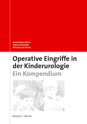 Dietz / Schuster / Stehr | Operative Kinderurologie | Buch | 978-3-89935-148-4 | sack.de