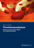 von Eiff |  Thromboseprophylaxe Klinische und ökonomische Effekte von Prophylaxestrümpfen | eBook | Sack Fachmedien