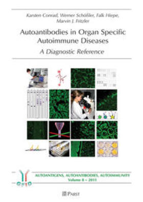 Conrad / Schößler / Hiepe | Autoantibodies in Organ Specific Autoimmune Diseases | Buch | 978-3-89967-734-8 | sack.de