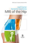 Karantanas / Kramer |  MRI of the Hip | Buch |  Sack Fachmedien