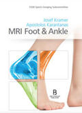 Karantanas / Kramer |  MRI Foot & Ankle | Buch |  Sack Fachmedien