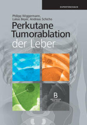 Wiggermann / Beyer / Schicho | Perkutane Tumorablation der Leber | Buch | 978-3-902933-79-9 | sack.de