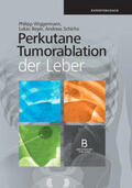 Wiggermann / Beyer / Schicho |  Perkutane Tumorablation der Leber | Buch |  Sack Fachmedien