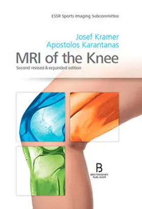Kamer / Karantanas |  MRI of the Knee | Buch |  Sack Fachmedien