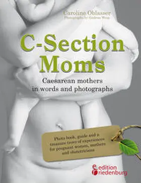Oblasser |  C-Section Moms - Caesarean mothers in words and photographs | Buch |  Sack Fachmedien