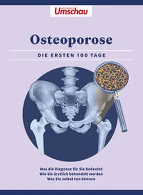 Horsthemke |  Apotheken Umschau: Osteoporose | Buch |  Sack Fachmedien