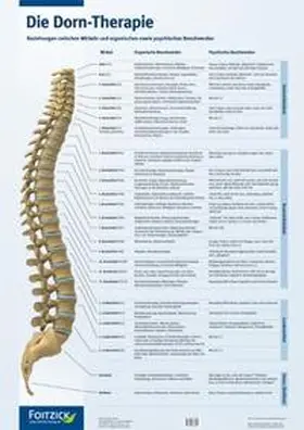 Schwarz / Koch |  Die Dorn-Therapie. Poster 59,4 x 84 cm | Sonstiges |  Sack Fachmedien