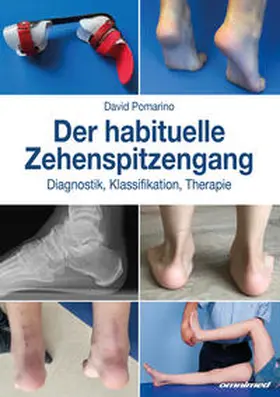 Pomarino / Brunner |  Der habituelle Zehenspitzengang | Buch |  Sack Fachmedien