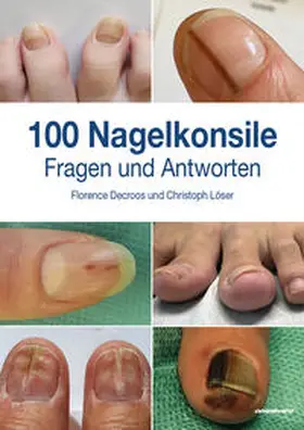 Löser / Decroos |  100 Nagelkonsile | Buch |  Sack Fachmedien
