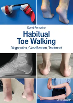 Pomarino |  Habitual toe walking | Buch |  Sack Fachmedien