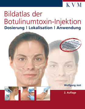 Jost | Bildatlas der Botulinumtoxin-Injektion | Buch | 978-3-932119-41-5 | sack.de
