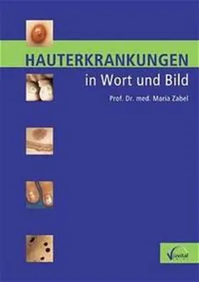 Zabel |  Hauterkrankungen in Wort und Bild | Buch |  Sack Fachmedien