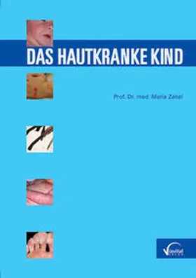 Zabel |  Das hautkranke Kind | Buch |  Sack Fachmedien