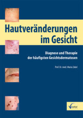 Zabel | Maria Zabel: Hautveränderungen im Gesicht | Buch | 978-3-934371-47-7 | sack.de