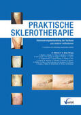 Hübner / Breu |  Praktische Sklerotherapie | Buch |  Sack Fachmedien