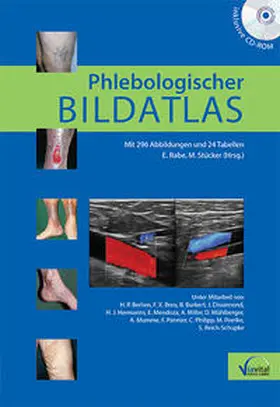 Rabe / Stücker |  Phlebologischer Bildatlas | Buch |  Sack Fachmedien