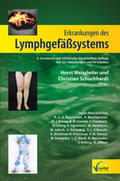 Weissleder / Schuchhardt |  Erkrankungen des Lymphgefäßsystems | Buch |  Sack Fachmedien
