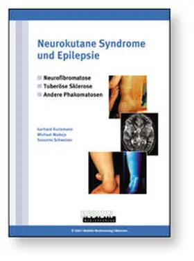 Kurlemann / Madeja / Schweizer | Neurokutane Syndrome und Epilepsie | Buch | 978-3-936715-16-3 | sack.de