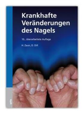 Zaun / Dill | Zaun, H: Krankh. Veränderung d. Nagels | Buch | 978-3-938509-20-3 | sack.de