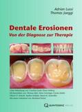 Jaeggi / Lussi |  Dentale Erosionen | Buch |  Sack Fachmedien