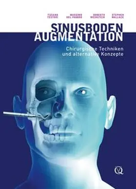 Testori / del Fabbro / Weinstein | Sinusbodenaugmentation | Buch | 978-3-938947-21-0 | www.sack.de