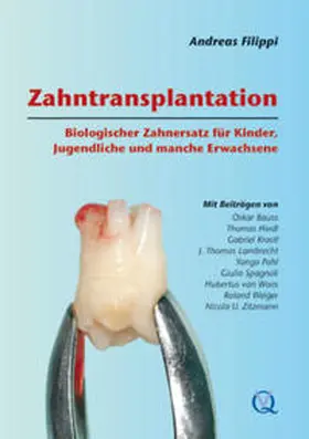 Filippi |  Zahntransplantation | Buch |  Sack Fachmedien
